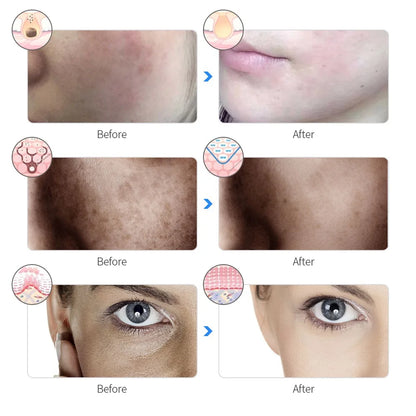 Mascarilla LED Facial para el cuidado de la piel, recargable